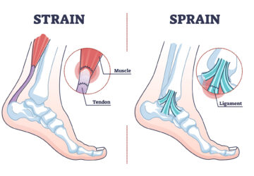 Sprains vs Strains